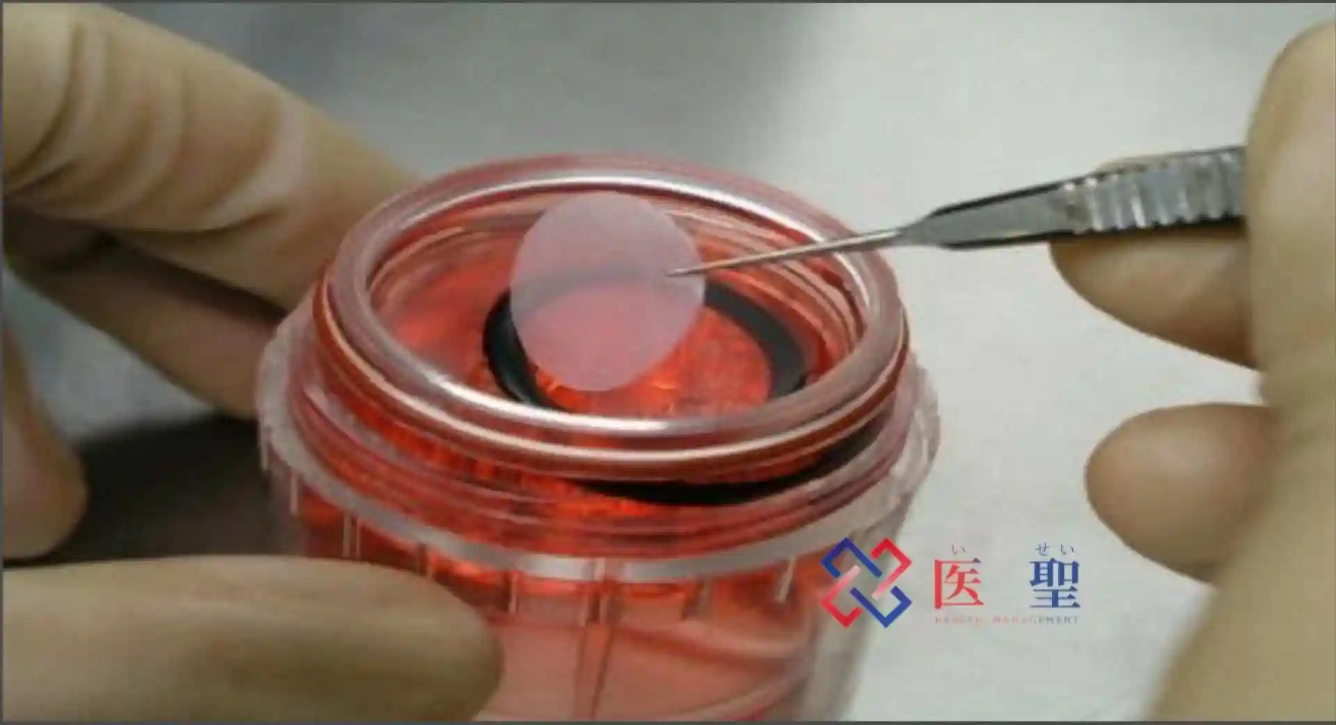 isei health:“角膜上皮干细胞衰竭症”日本干细胞产品樱花膜上市