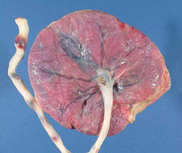 85后美女捐献干细胞救人：只要采集顺利 这点痛算什么？