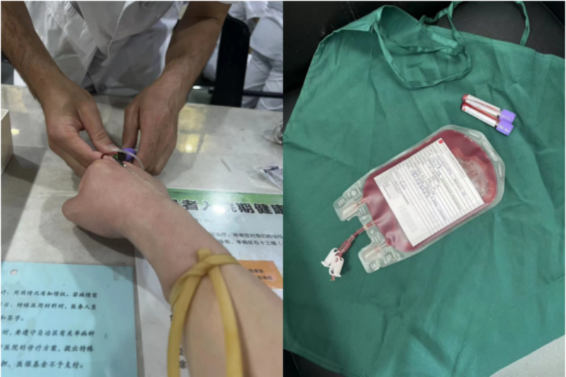 2期专栏述评 ▏​自体脂肪移植的相关研究方向和热点（全文）