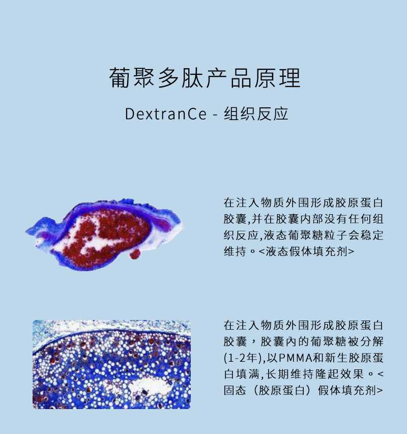乳腺癌转移的机制研究取得新进展 广东科研团队获国家自然科学奖二等奖