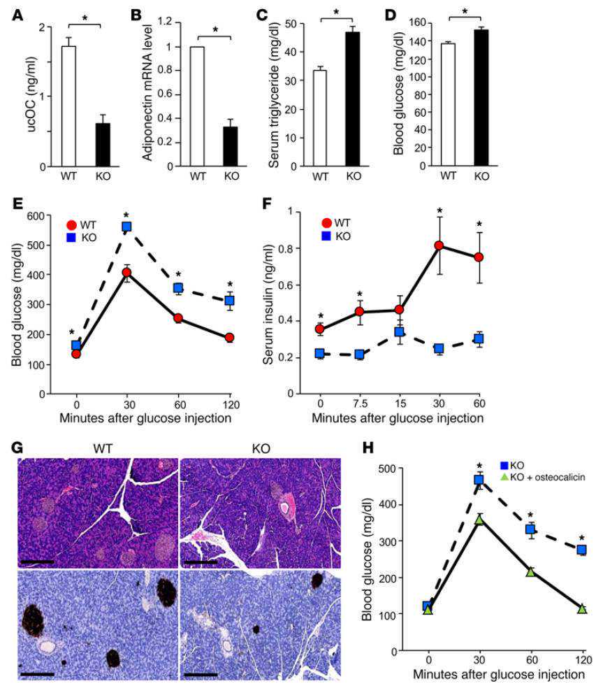 类器官揭示大脑形成过程：出生时大脑就像核桃一样布满褶皱