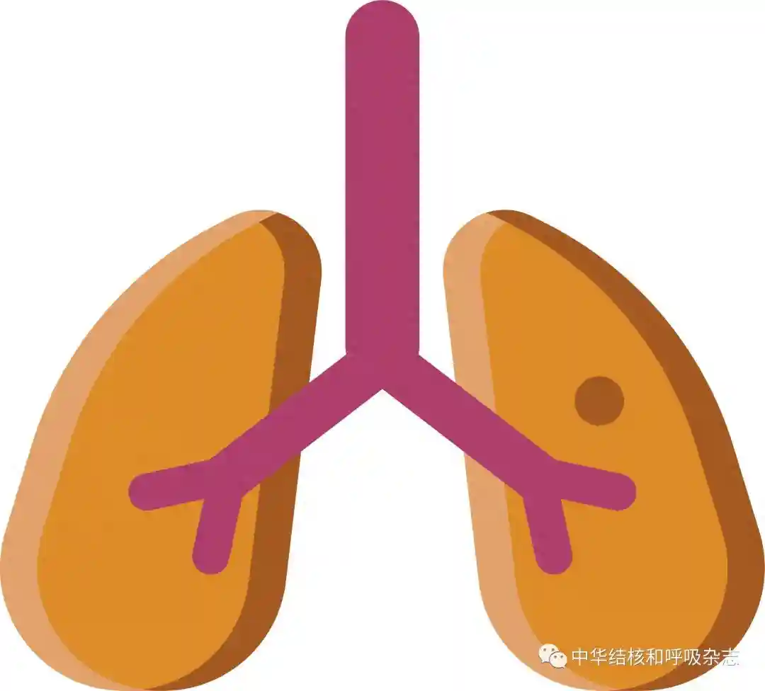 【诊疗方案】成人支气管扩张症病因学诊断专家共识