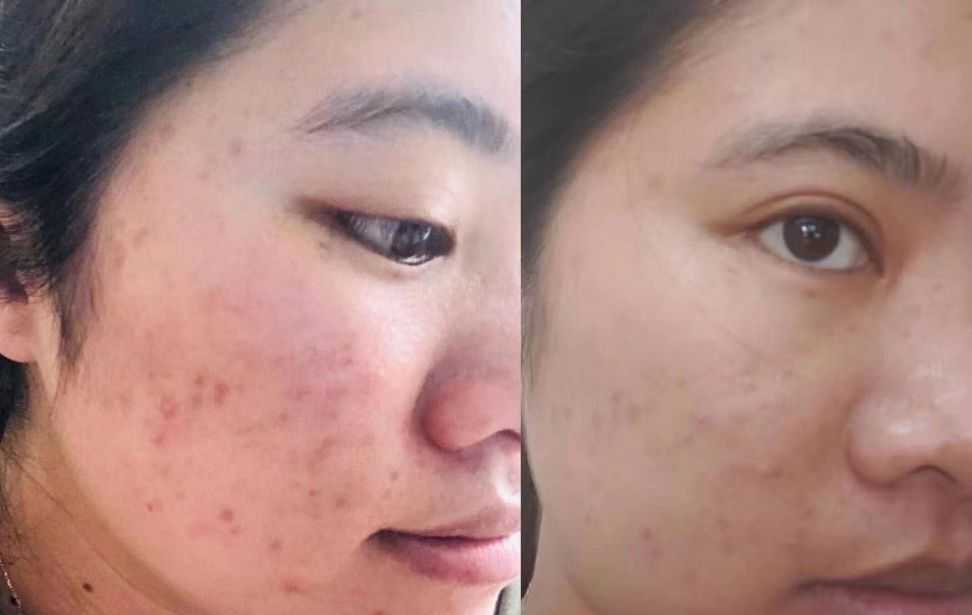 邯郸市交巡警首例民警志愿者成功捐献造血干细胞